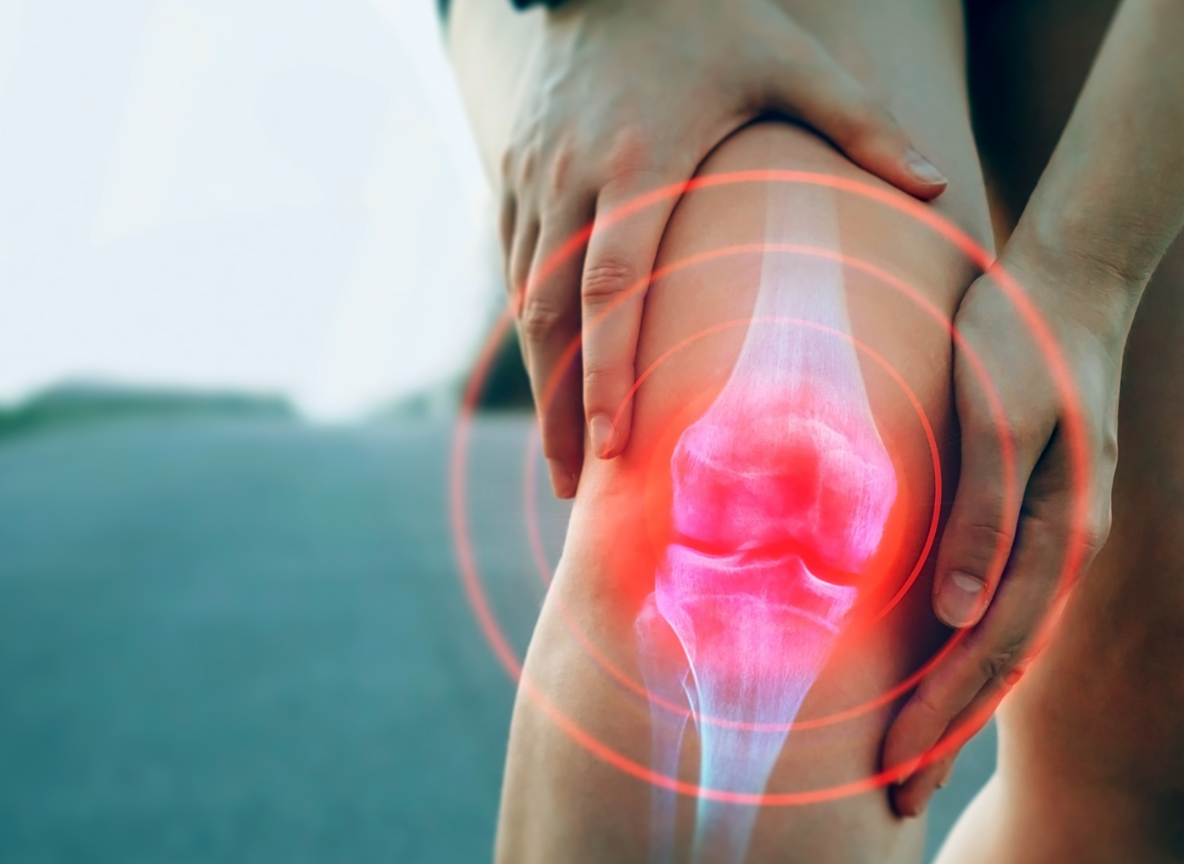 Injections PRP dans la gonarthrose – Dr Pierre DEKEUWER, Hyères et Toulon (Var)